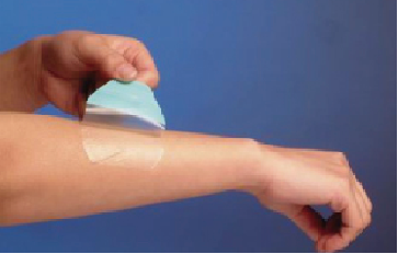 醫(yī)用膜產(chǎn)品